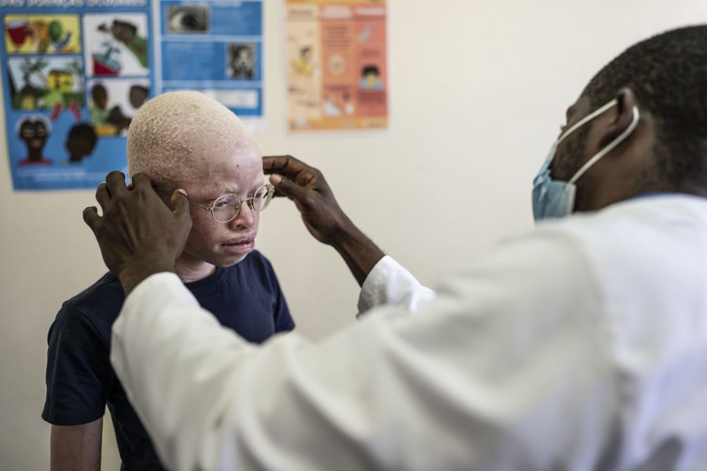 An albino boy trying on glasses An albino boy trying on glasses