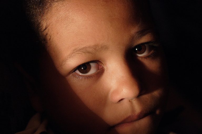 Trachoma